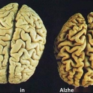 一口牙拯救了阿汤哥的颜值！25组不可思议的对比照